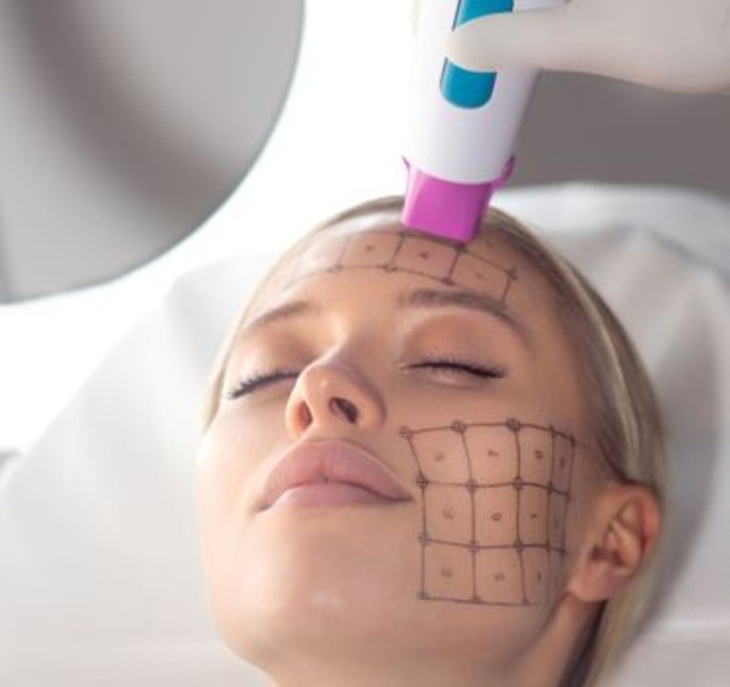 Revitalize Your Skin with Thermage FLX Facelift at Santorini Spa