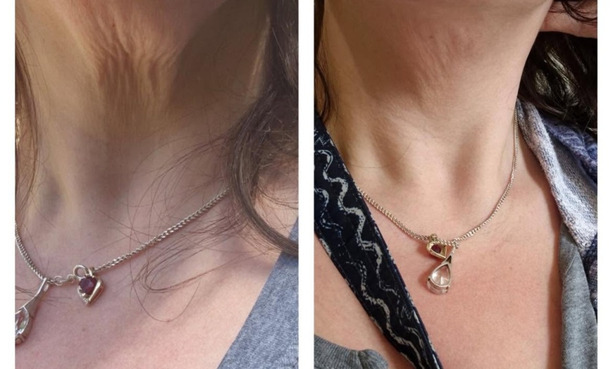 Image 1: Ultimate HIFU Experience: Face and Neck with RF