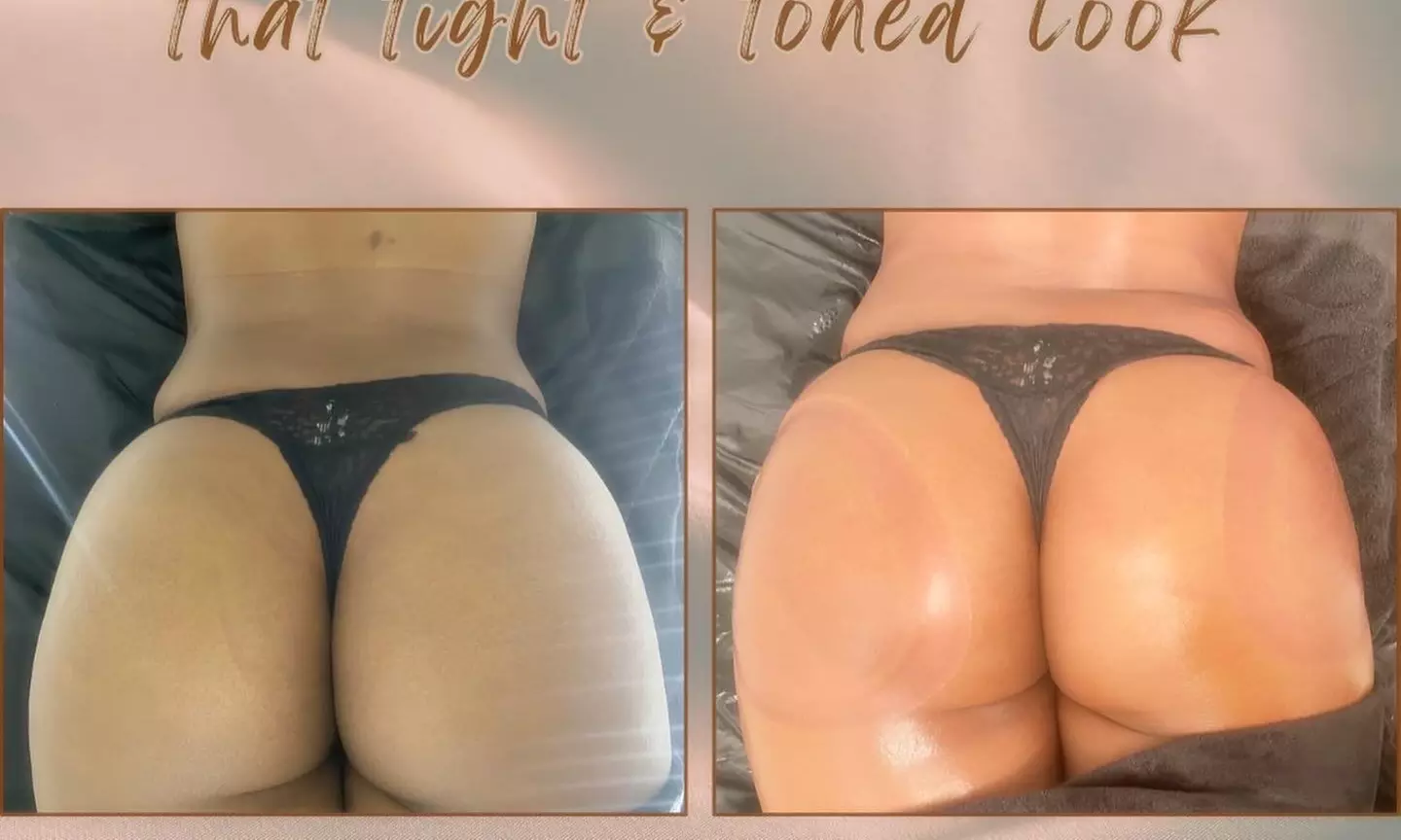 Transform Your Body with Ultrasonic Fat Reduction in Philly