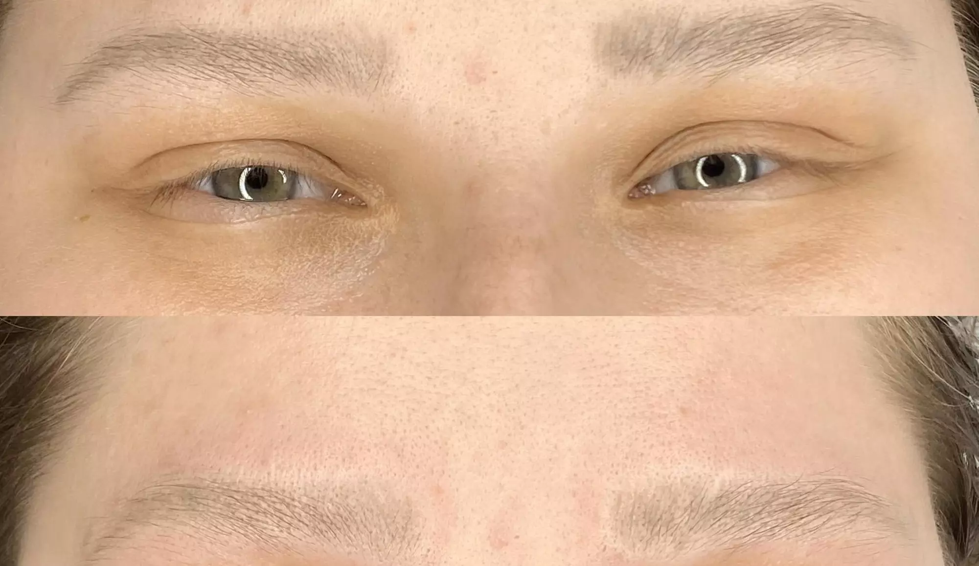 Laserowe oraz bezlaserowe usuwanie makijażu permanentnego brwi i ust