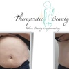 Image 2: Transform Your Tummy with Three, or Six Targeted Sessions!