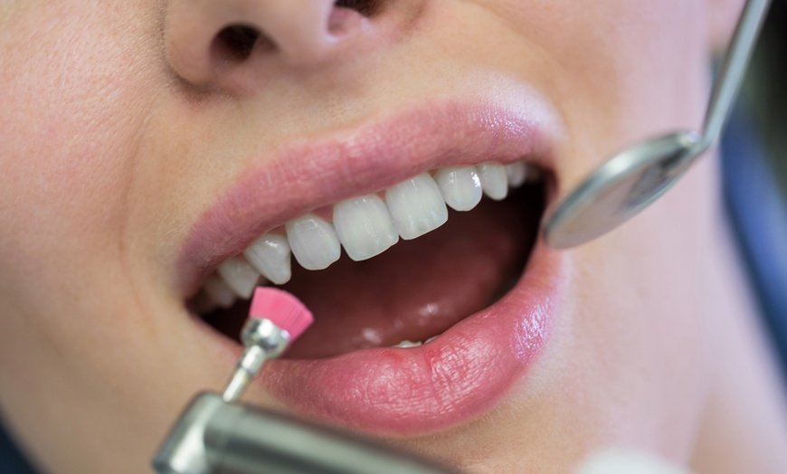 Image 2: Brighten Your Smile with a Dental Exam Scale & Polish at GA Skincare!