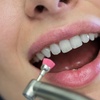 Image 2: Brighten Your Smile with a Dental Exam Scale & Polish at GA Skincare!