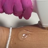Image 3: Smooth Skin w/ Six Laser Hair Removal on Small, Medium or Large Areas