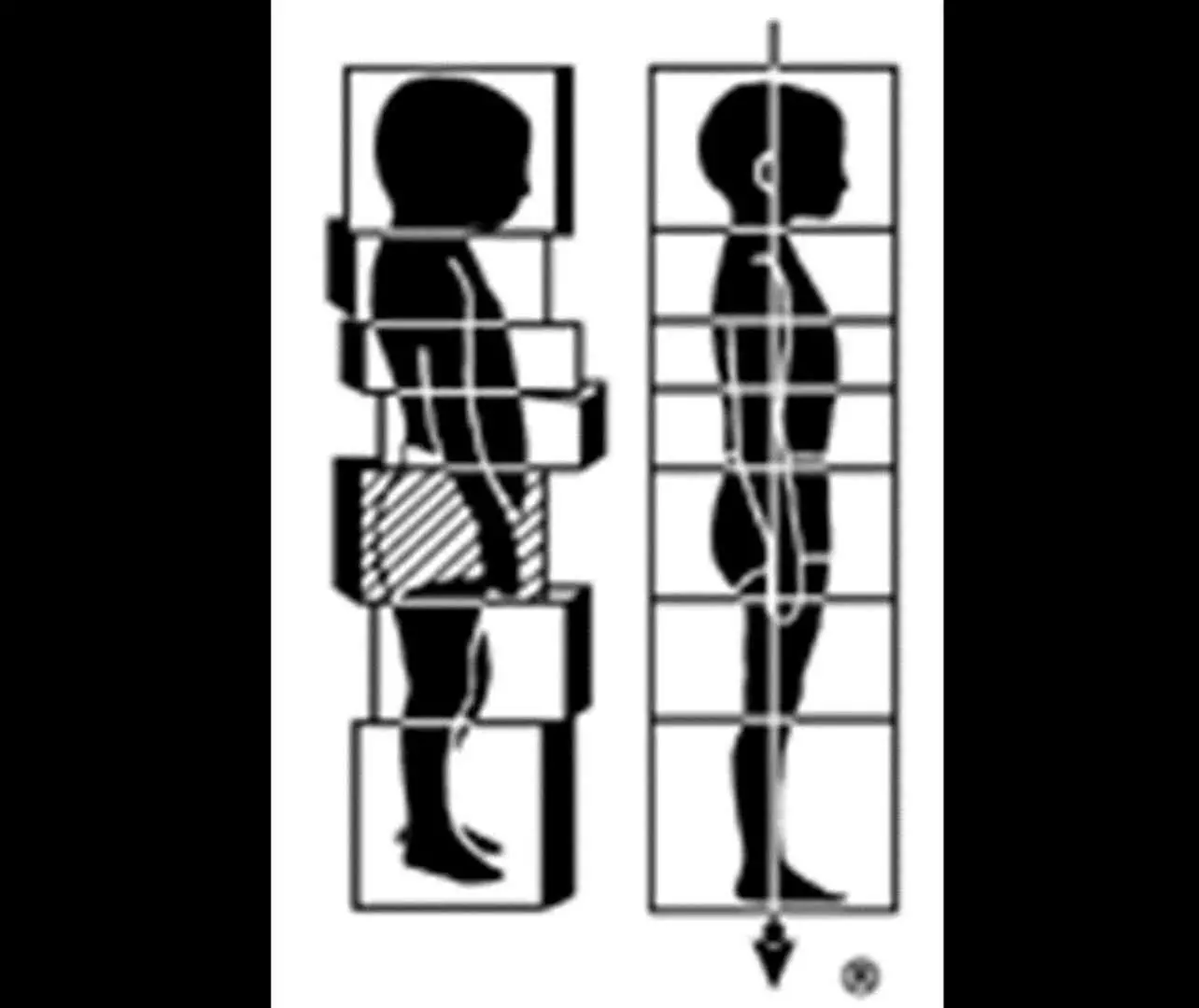 Enhance Your Fitness with One Rolfing Structural Integration Session