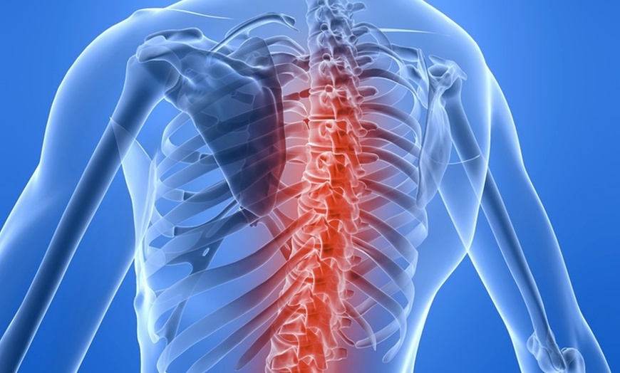 Image 3: Postural Assessment with X-Rays and 60 Minute Massage