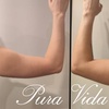 Image 1: Sculpt Your Silhouette with Non‑Invasive at Pura Vida Esthetiques LLC