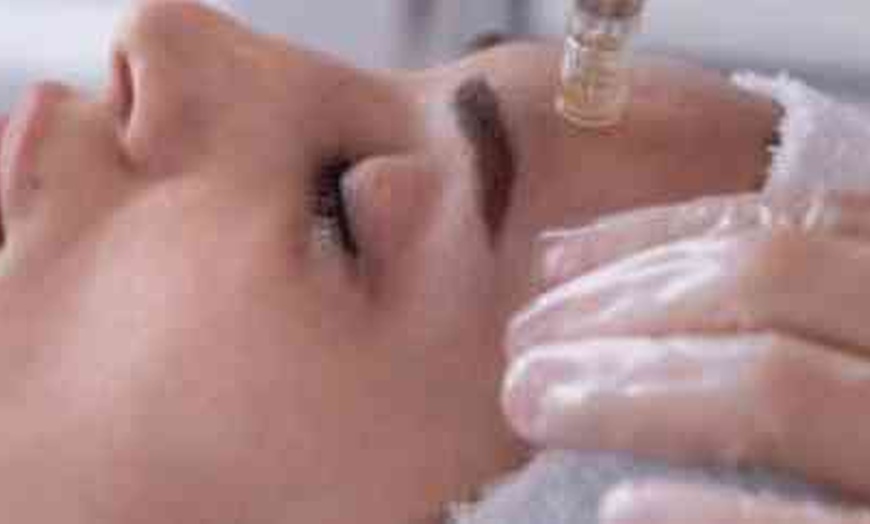 Image 1: Unlock Radiant Skin with Xtreme Facials' Microneedling for Face, Offering Up to 60% Off