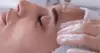 Unlock Radiant Skin with Xtreme Facials' Microneedling for Face, Offering Up to 60% Off