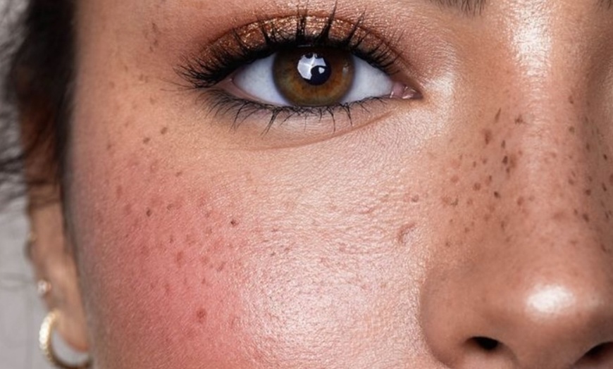 Image 2: Achieve Natural-Looking Freckles w/ Organic, Long-Lasting Application