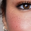 Image 2: Achieve Natural-Looking Freckles w/ Organic, Long-Lasting Application