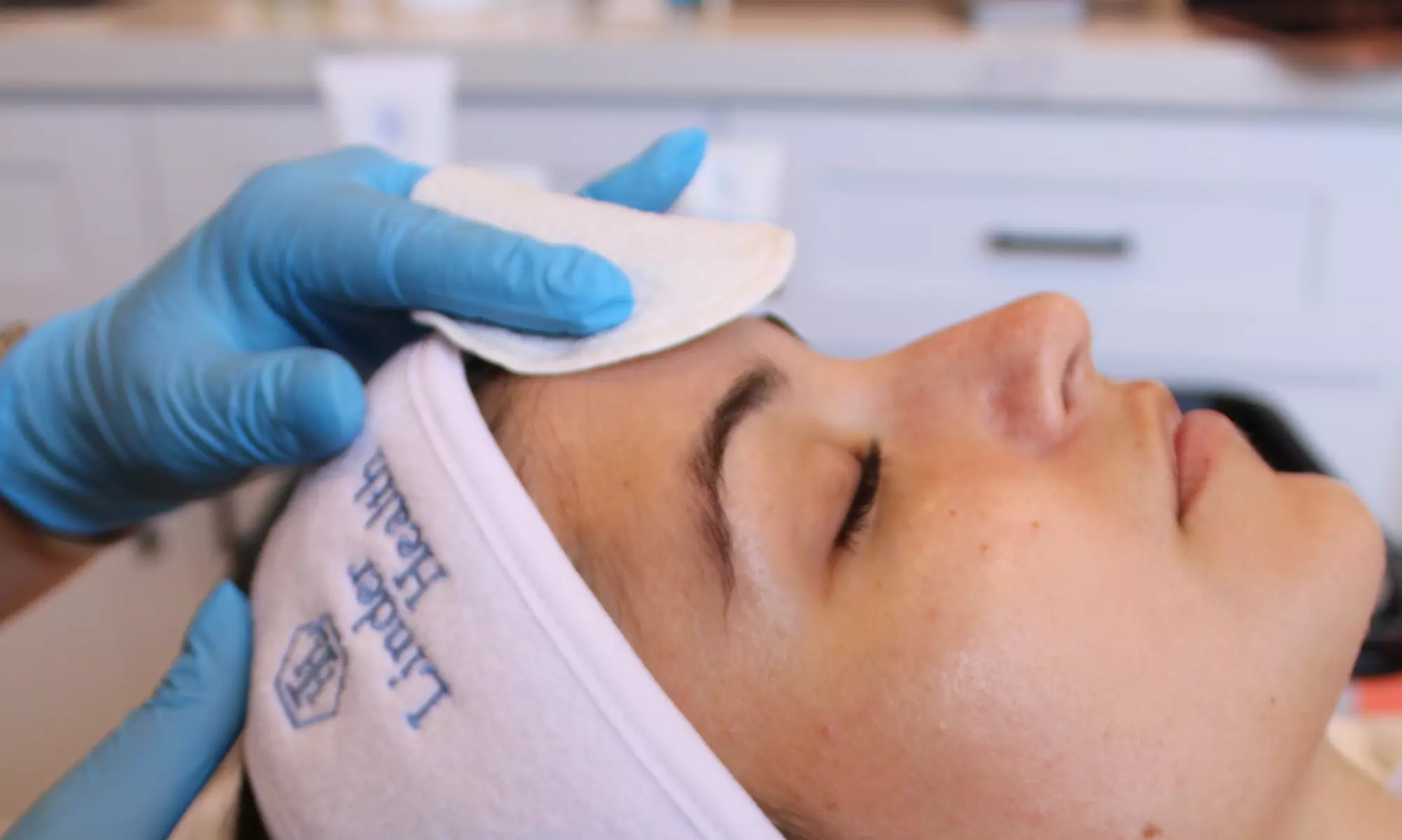 Get One or Two Full Face and Neck Chemical Peel