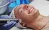 Up to 67% Off on Micro-Needling at Euro glow facial salon