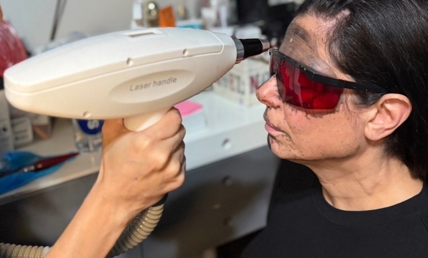 Image 4: Lymphatic Drainage, Body Sculpting, and Carbon Laser Facials