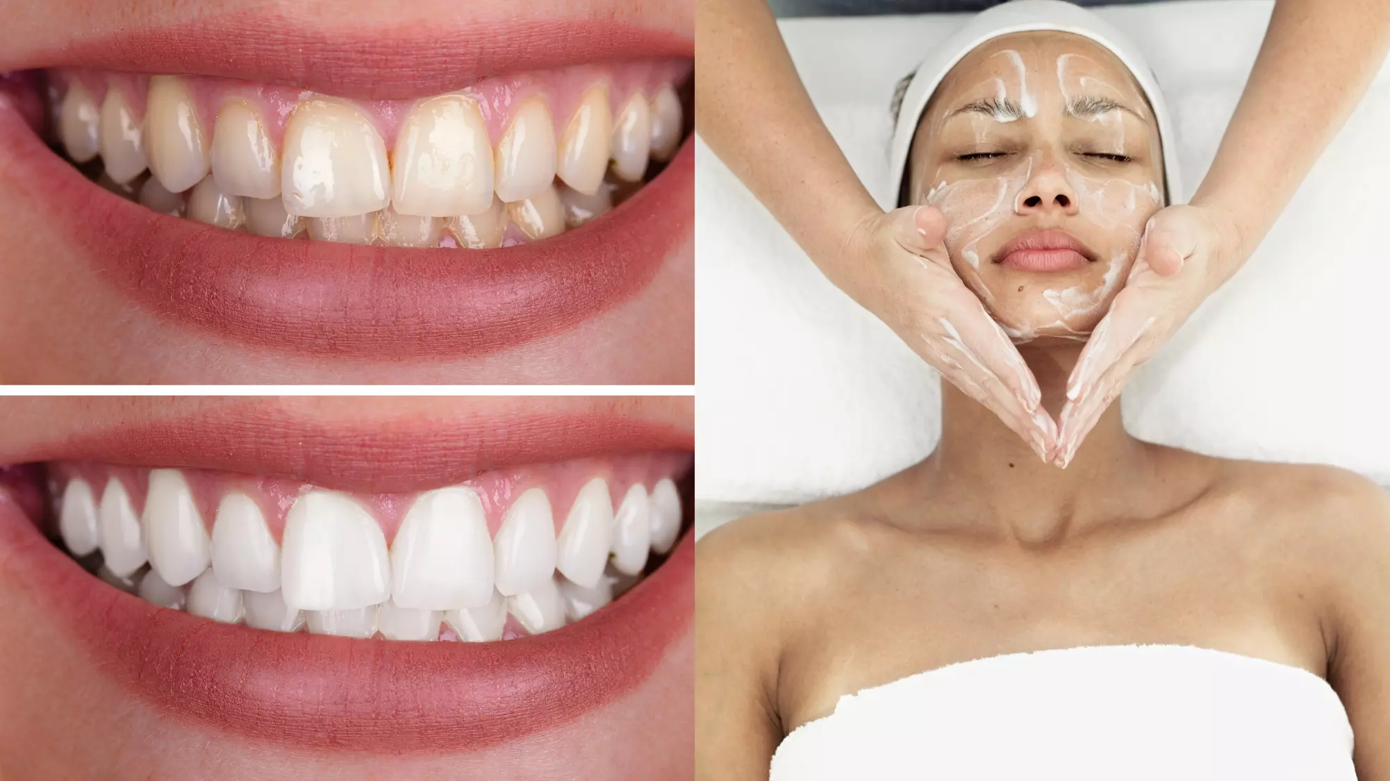 Up to 33% Off on Teeth Whitening - In-Office - Branded (Zoom, Brite Smile) at Sudden Gleam - Primary Image