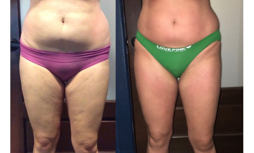 Image 2: One or Three Sculpt POD Session 