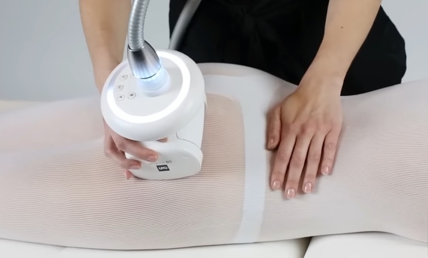 Image 1: Up to 50% Off on Endermologie at The Contour Method