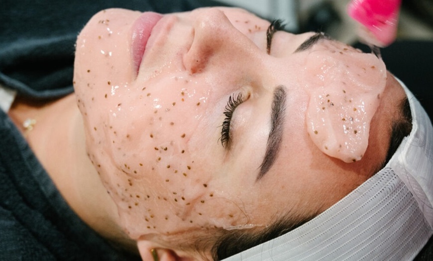 Image 1: Up to 79% Off on Facial - Mask at UK Aesthetics Lounge