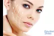Refresh Your Appearance with 20, 40 or 60 Units of  at EevolveSelf Medspa (Up to 47% Off) - Second Medium