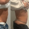 Image 6: Up to 61% Off on Ultrasonic Fat Reduction at ILLUME Skin Spa