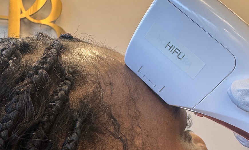 Image 3: HIFU Non-Invasive Lifting, Skin Tightening of Skin, Jawline and Cheeks