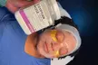 Up to 50% Off on Facial at Ferocious Skin Deep - Second Medium