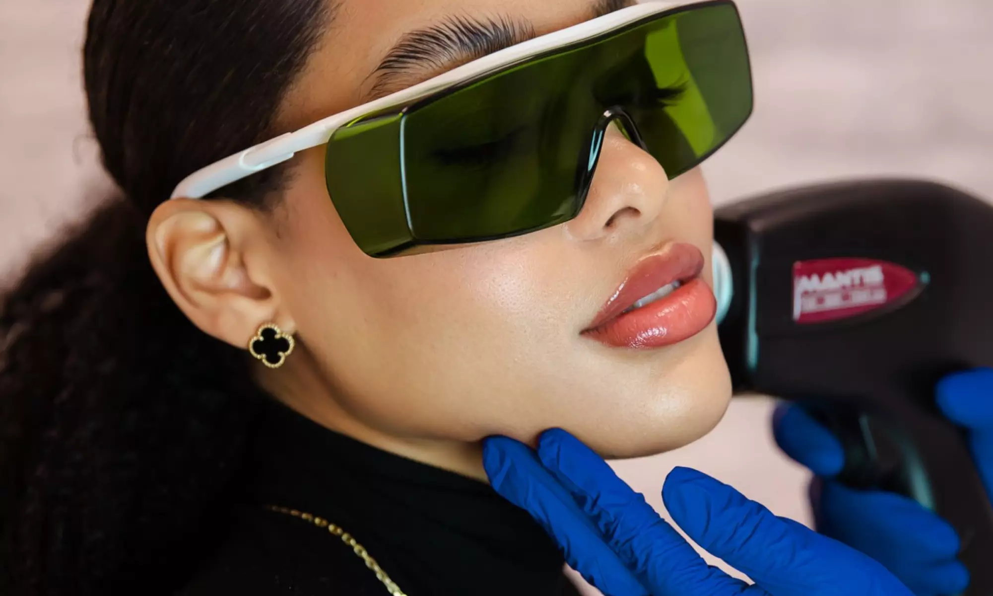 Depilacja laserowa na wybrane partie ciała