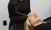 Peach Skin & Laser offers microneedling sessions with hyaluronic serum, up to 71% off