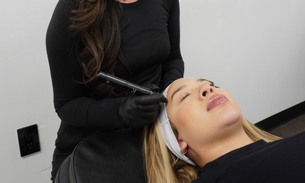 One Microneedling Session - Peach Skin & Laser - Yuma