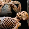 Image 1: Bodies Human: Interactive Anatomy & Health Science Exhibits