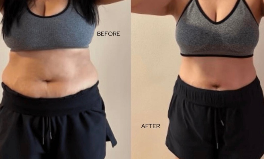 Image 3: 5 45-Min Laser Lipo Sessions with Ultrasound Cavitation