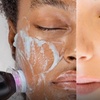 Image 3: Up to 49% Off on Facial at Mynd Spa