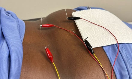 Dr. Acupuncture Consultation - Med Therapy and Spa