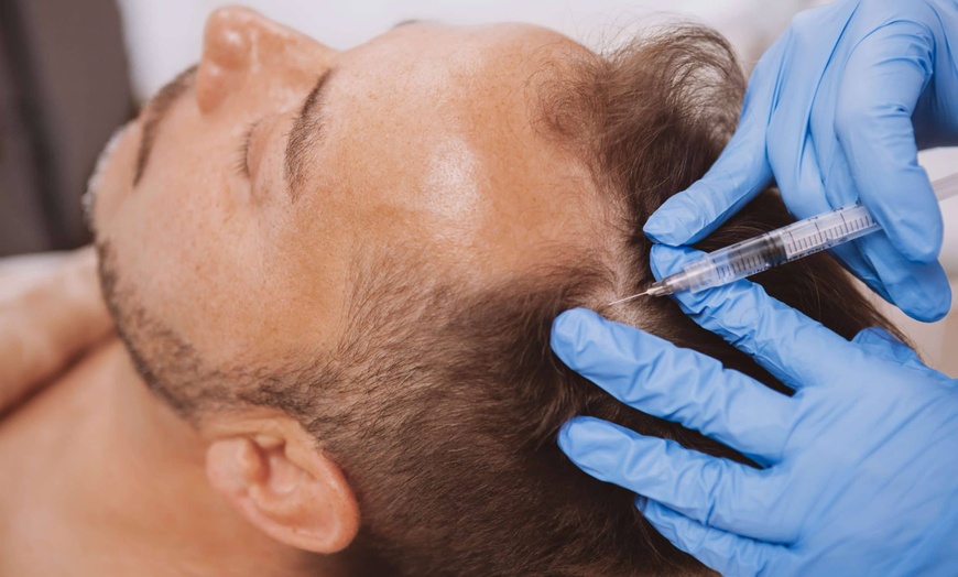 Image 1: Facial - Eigenblut bei DaVinci Aesthetics GmbH