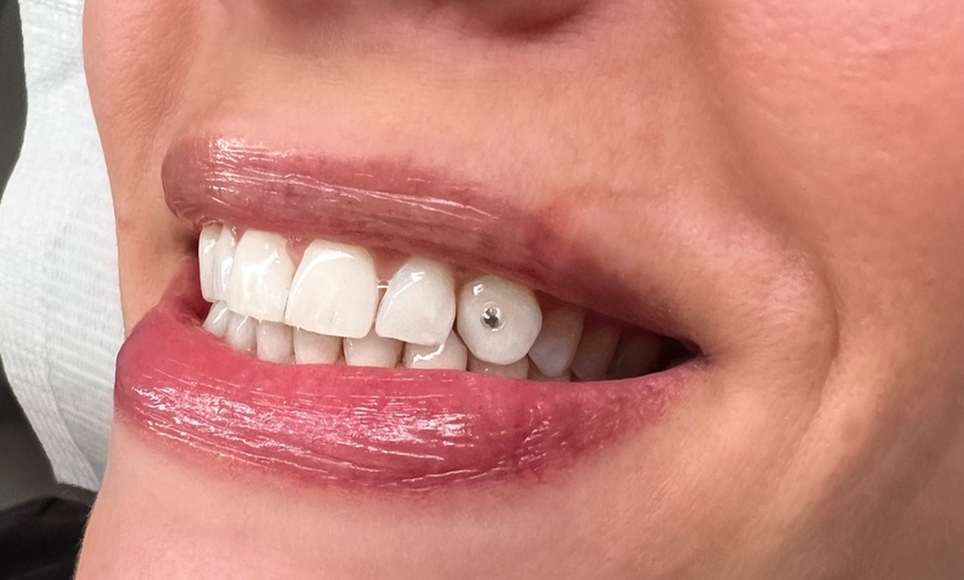 Image 2: Sparkle up with One or Two Tooth Gems for a Bright Smile