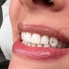 Image 2: Sparkle up with One or Two Tooth Gems for a Bright Smile