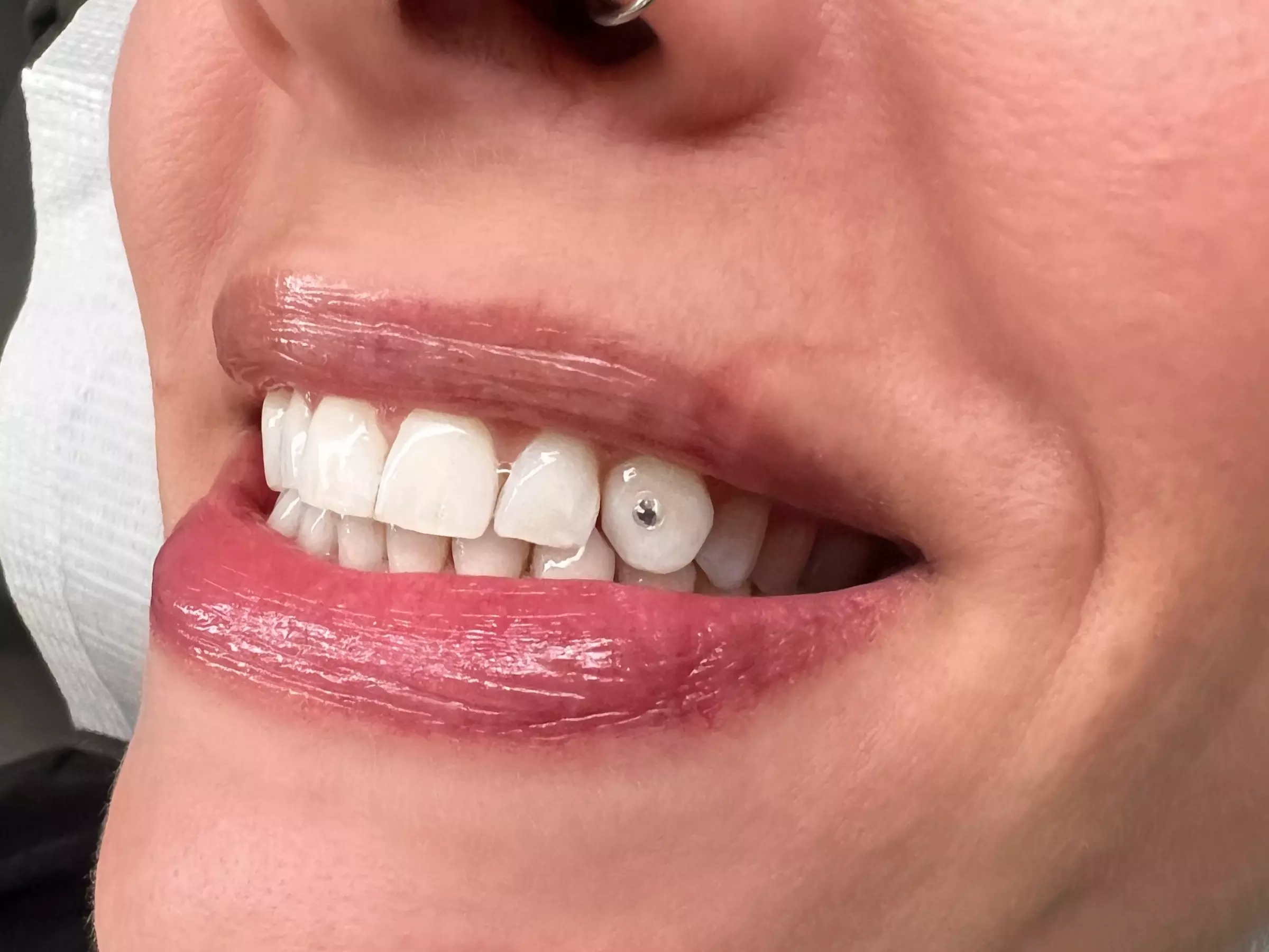 Sparkle up with One or Two Tooth Gems for a Bright Smile