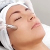 Image 1: Up to 35% Off on Microdermabrasion at Sweet Rituals Skin Spa