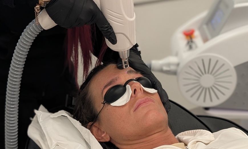 Image 4: Up to 55% Off on Tattoo Removal at Gia laser clinic