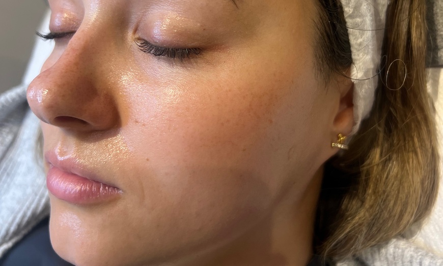 Image 3: Relax with a 60-Min Deep Cleanse Facial or Bye Peach Dermaplane Facial