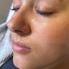 Image 3: Relax with a 60-Min Deep Cleanse Facial or Bye Peach Dermaplane Facial