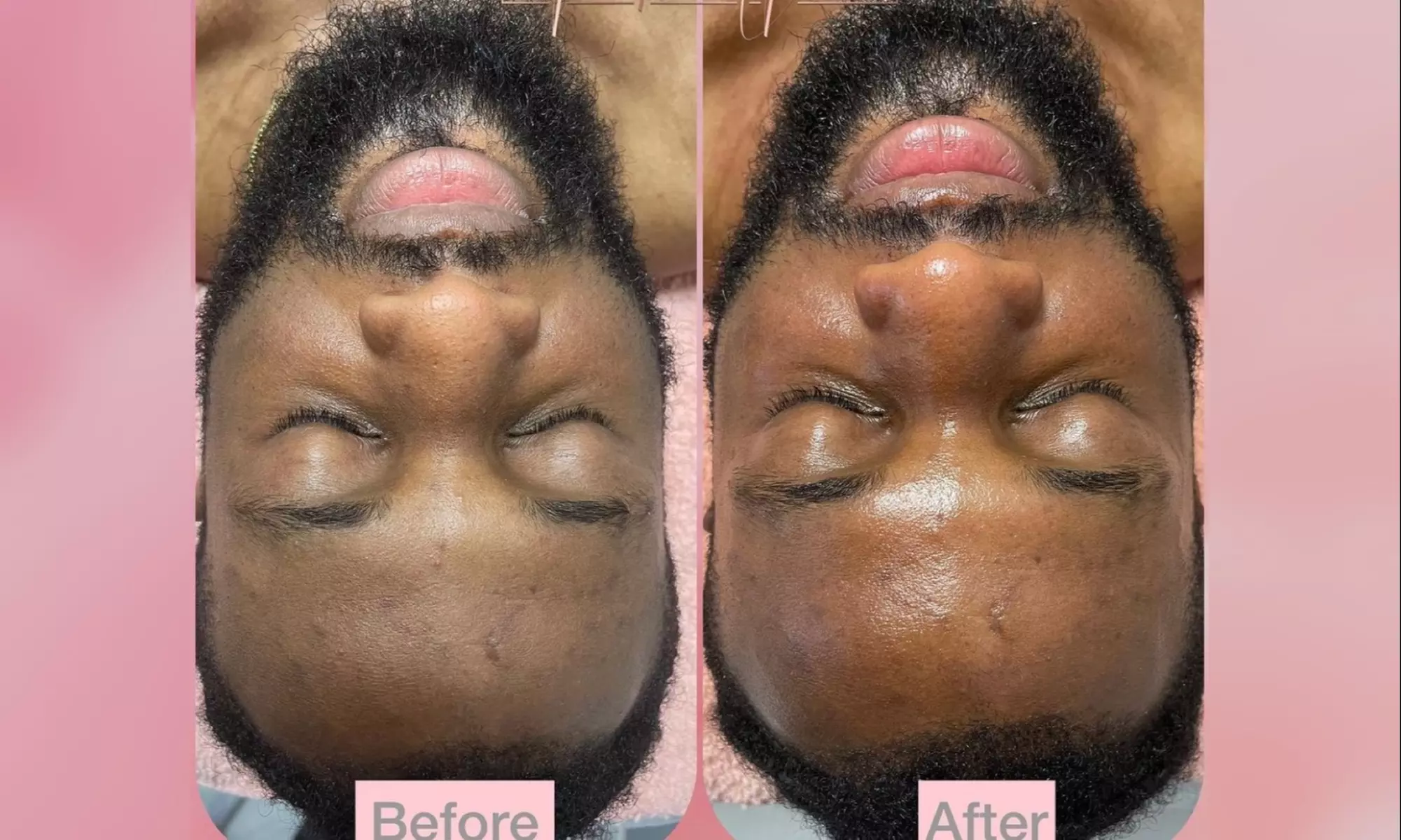 Experience a Men's Facial for Clean and Radiant Skin
