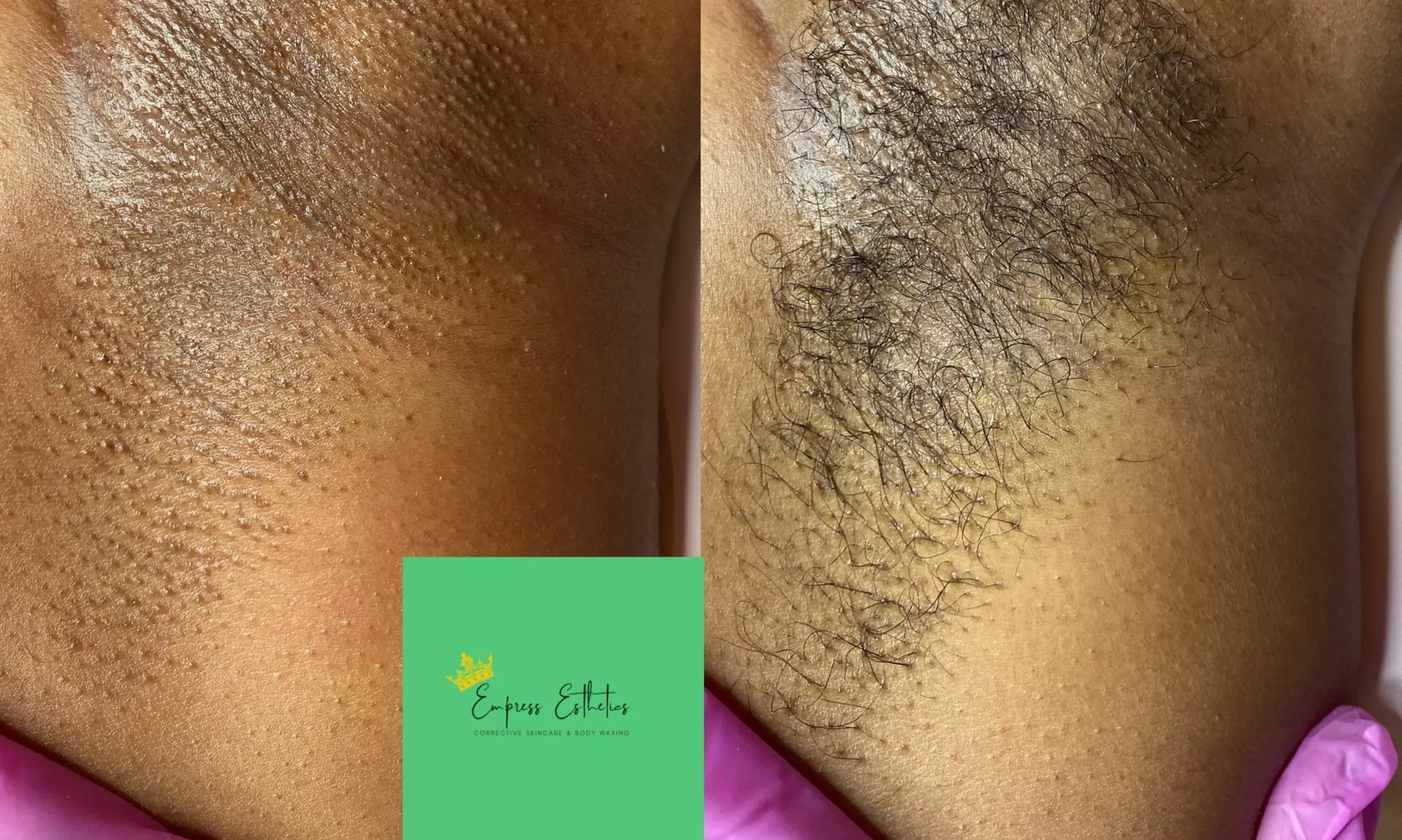 Up to 37% Off on Brazilian / Bikini Waxing at Empress Esthetics LLC., - Second Medium
