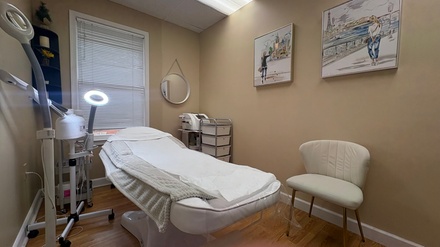 One Micro-Needling Treatment - Kate Cosmedici Medical Spa