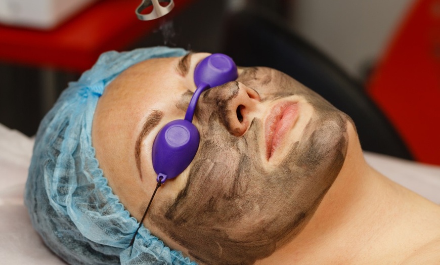 Image 3: Get Glowing Skin with 1 or 6 Sessions of Carbon Laser Peel Facial at Agatha K Micropigmentation (Up to 48% Off)