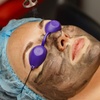Image 3: Get Glowing Skin with 1 or 6 Sessions of Carbon Laser Peel Facial at Agatha K Micropigmentation (Up to 48% Off)