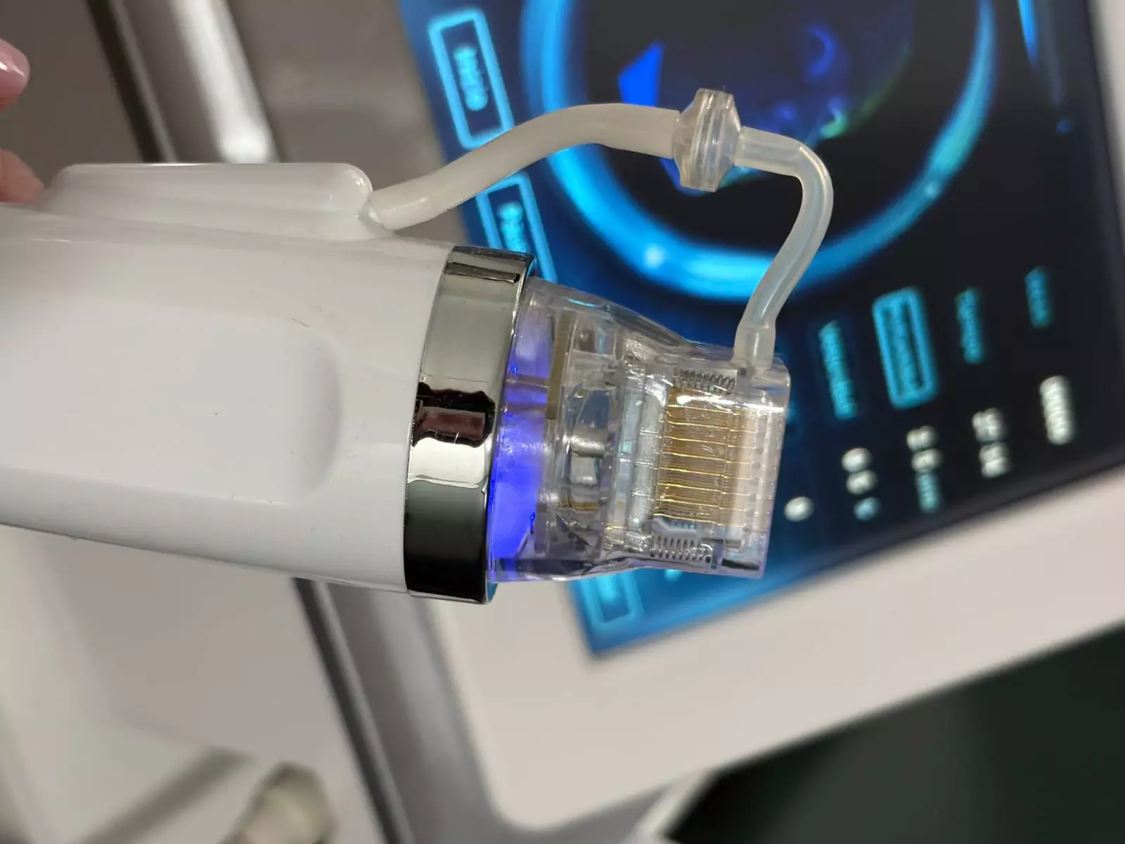 Microneedling con radiofrecuencia fraccionada en rostro para 1 persona