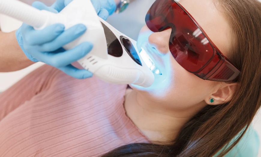 Image 5: Tanden bleken bij House of Maus Rotterdam 5 x 15 minuten