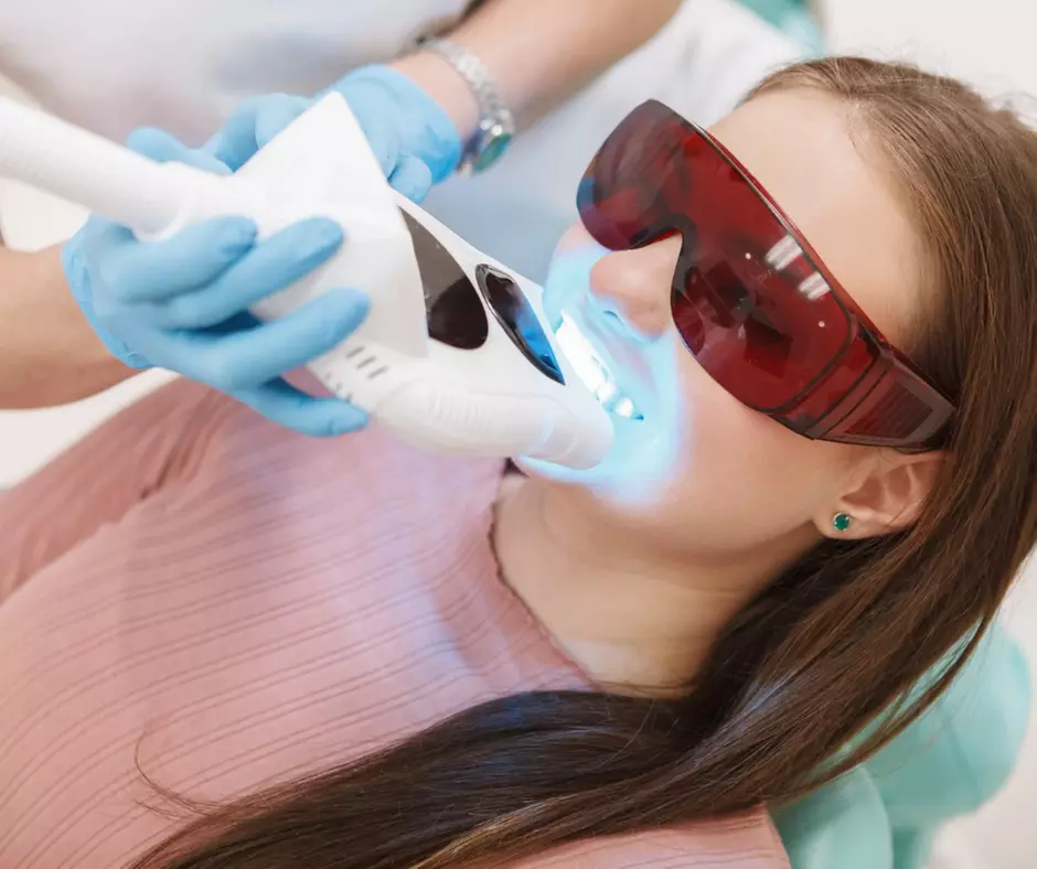 Tanden bleken bij House of Maus Rotterdam 5 x 15 minuten