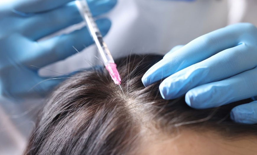 Image 5: 1 sesión de mesoterapia inyectada facial o capilar para 1 persona